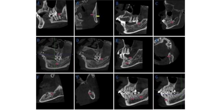 International Journal of Human Anatomy-BMC