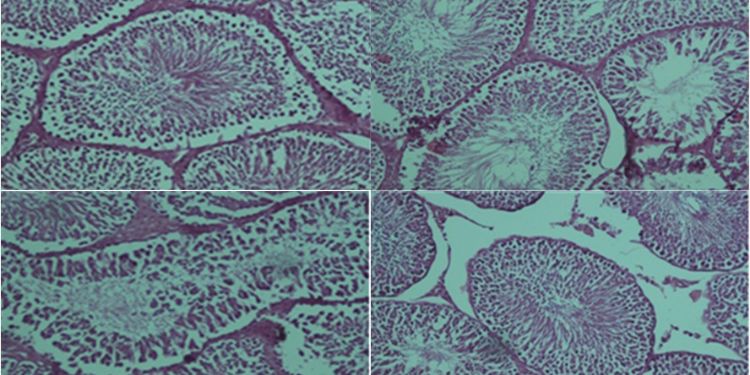 Journal of Antioxidant Activity-Oxidative stress