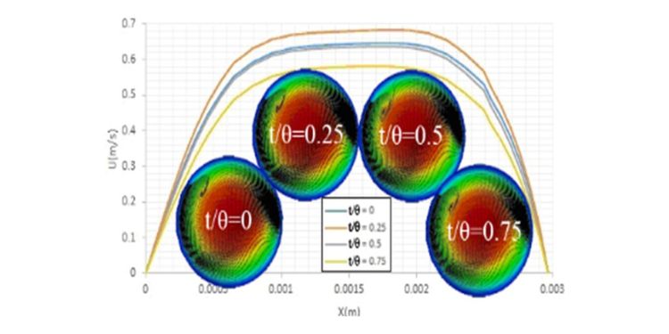 International Journal of Heart Research-Coronary arteries