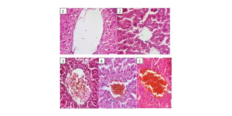 International Journal of Lipids-Cholesterol