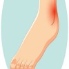 Journal of Tissue Repair and Regeneration - Diabetic Foot Ulcer