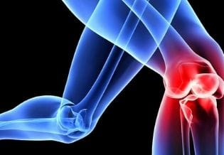 Osteoarthritis and Cartilage