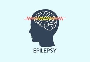 Epilepsy